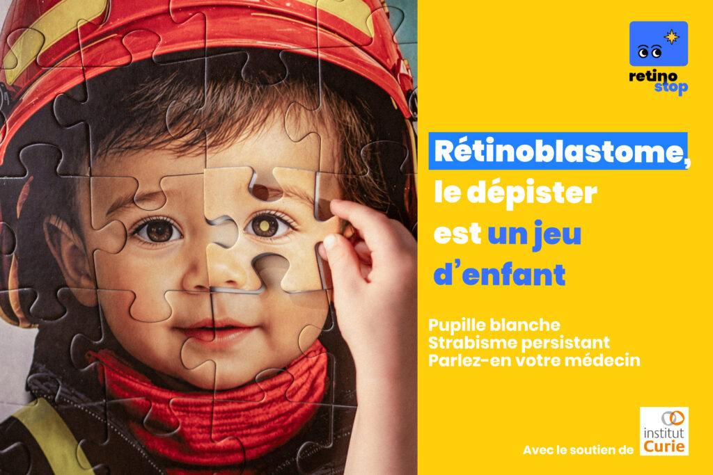 Rétinoblastome : le repérer est un jeu d’enfant